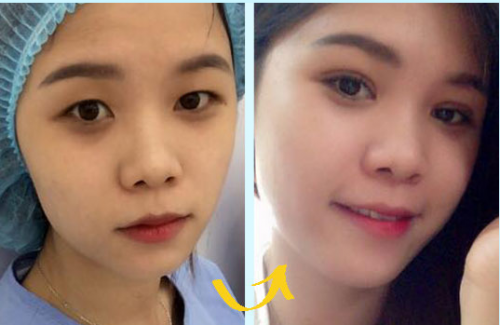 Ảnh2