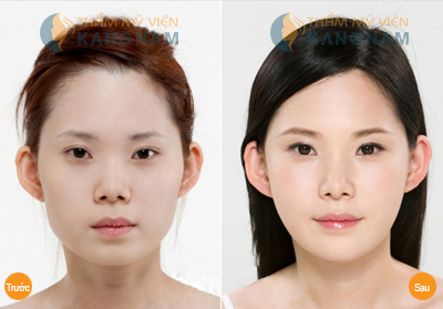 3 mẹo “hô biến” mắt to tròn như sao Hàn