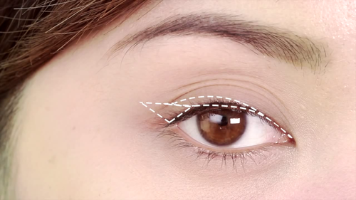 Đôi mắt nhiều mí khiến bạn cảm thấy tự ti