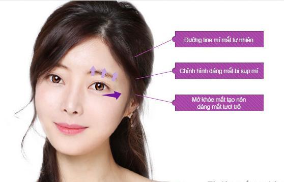 Thế nào là một đôi mắt đẹp?5