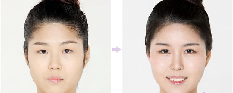 Thế nào là một đôi mắt đẹp?6