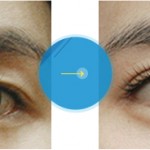Nhấn mí mắt Hàn Quốc ở đâu đẹp? 6 tiêu chí đánh giá chất lượng
