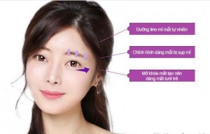 Mắt đẹp long lanh với kỹ thuật tạo khóe mắt mới nhất hiện nay