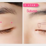 Kết quả sau bấm mí Dove Eyes tại Kangnam: Tổng hợp Video, hình ảnh