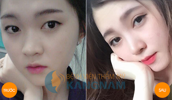 Kangnam - Bệnh viện thẩm mỹ tiêu chuẩn Hàn Quốc đầu tiên tại Việt Nam778