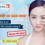 CHỮA SỤP MÍ MẮT BẨM SINH – xóa sụp mí – tạo mắt 2 mí chuẩn từng li