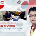 [OFF NGAY 20%]- Cắt mí mắt Plasma – Xu hướng thẩm mỹ Hot Hàn Quốc 2017